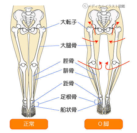 開く 痛い 股関節 と 開くと痛い股関節の痛みについて・・・船橋市のオステオパシー整体