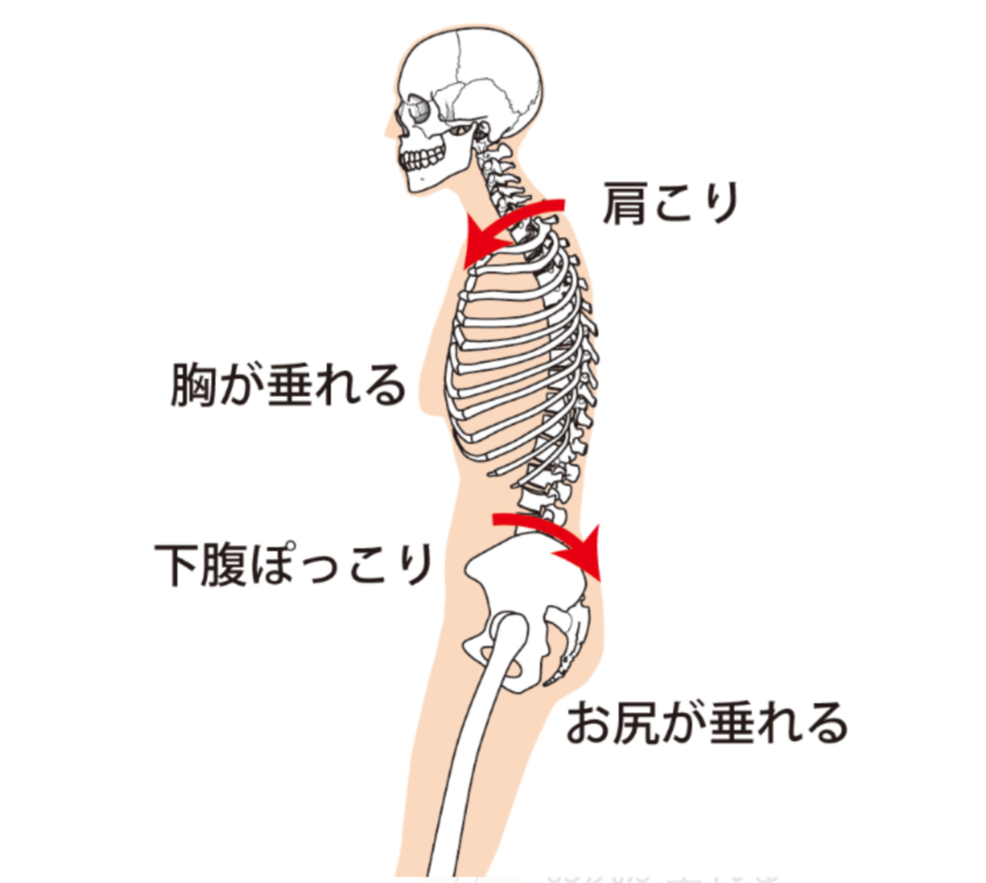 姿勢矯正