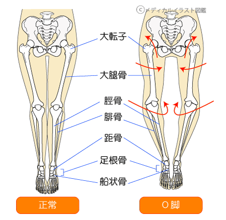 骨格矯正
